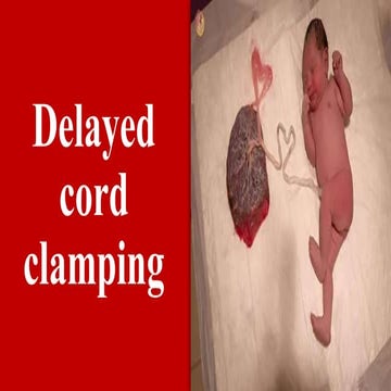 Delayed Cord Clamping- the Physiological Basis