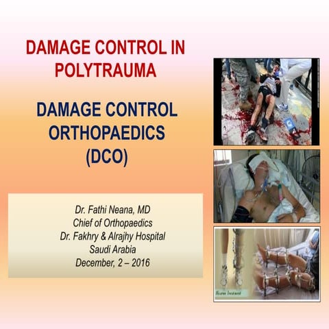  Damage Control Orthopaedics (DCO)