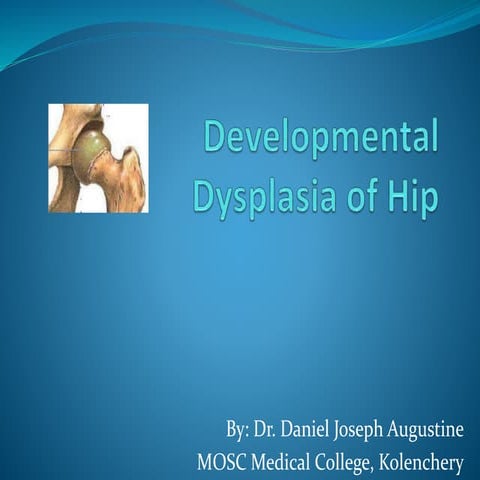 Developmental Dysplasia of Hip