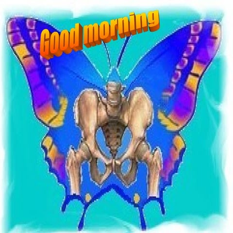 DDH Developmental Dysplasia of the Hip.ppt