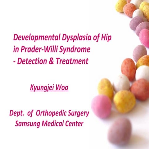 Developmental Dysplasia of Hip (DDH) in Prader-Willi Syndrome (PWS)