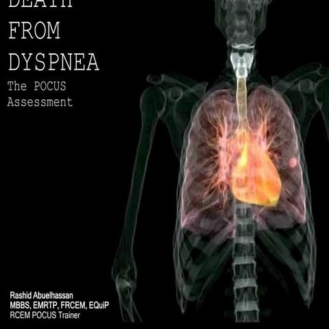 POCUS assessment of Dyspnea