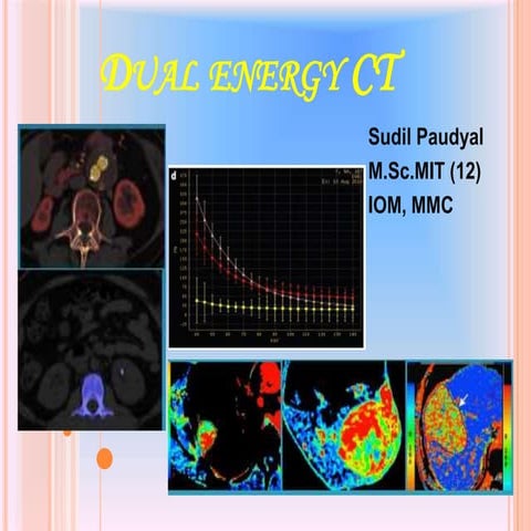Dual Energy CT