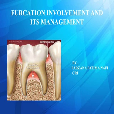 FURCATION INVOLVEMENT AND ITS MANAGEMENT