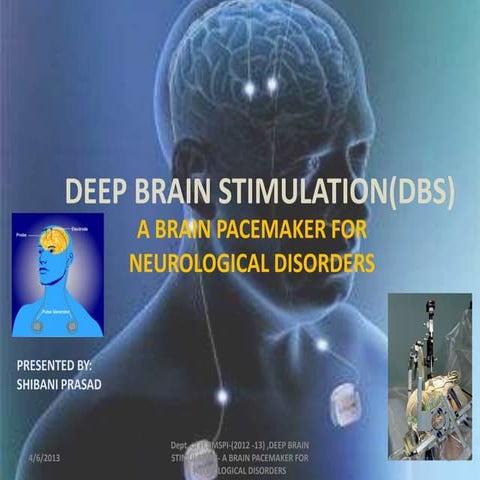 Deep brain stimulation
