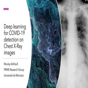 Deep learning for covid 19 detection on chest x-ray | PPT