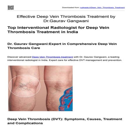 Comprehensive Guide to Prevention and Treatment of Deep Vein Thrombosis ...