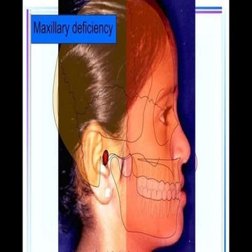 deficiency.pptx