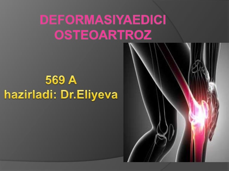 osteoartroza articulațiilor de deformare a mâinii