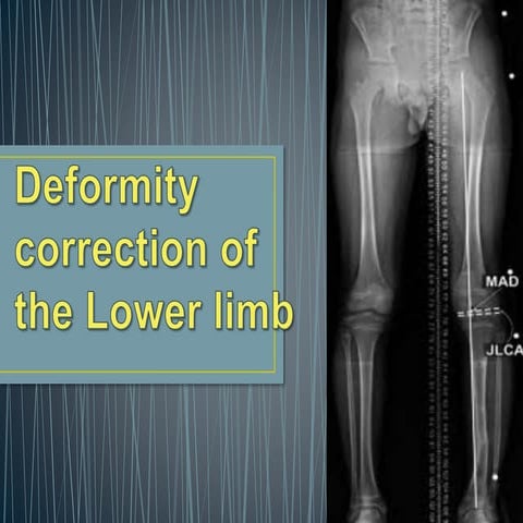 Deformity correction