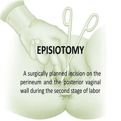 DELIVERY EPISIOTOMY.pptx