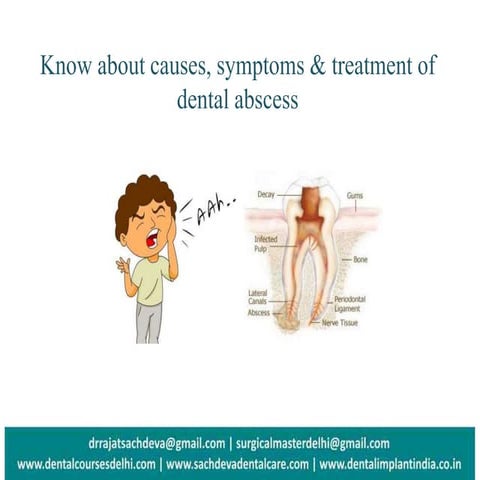 Dental Abscess