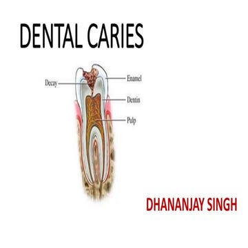 Dental caries.pptx