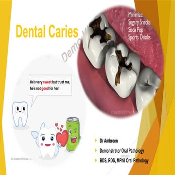 DENTAL CARIES lecture description it's prevention