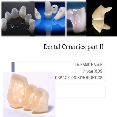 Dental ceramics part 2 