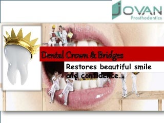 Dental Crown & Bridges Restores Beautiful Smile & Confidence Dental Crown & Bridges Restores Beautiful Smile & Confidence