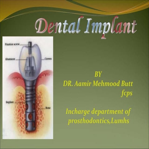 dental-implant-ppt