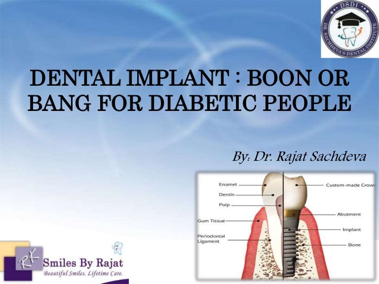 Dental implant in Diabetic Patient Dental Implant Solutions