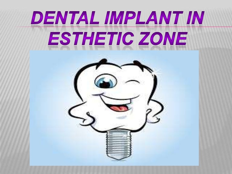 Dental implant in esthetic zone