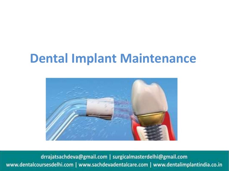 Dental Implant Maintenance , Dental Implant Care