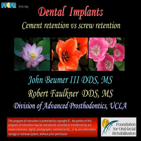 Dental implants   cement retention vs screw retention
