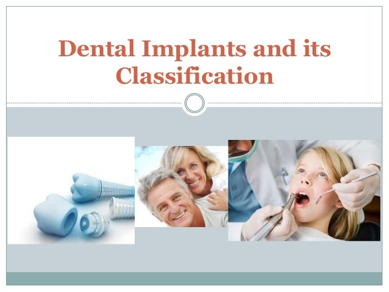 Dental implants and its classification