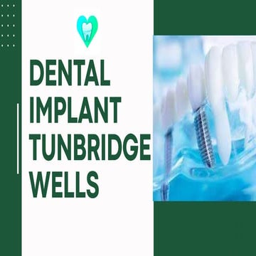 Dental Implant Tunbridge Wells. pptx | PPTX