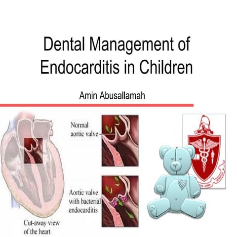 Dental management of endocarditis in children