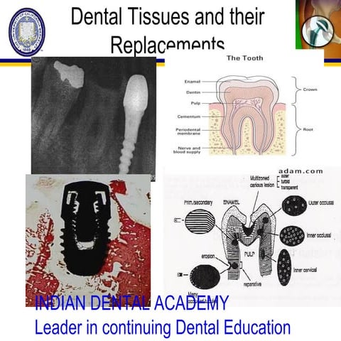 Dental tissues and their replacements/ oral surgery courses  