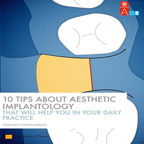 Dentalxp 10 tips for dental  implant placement