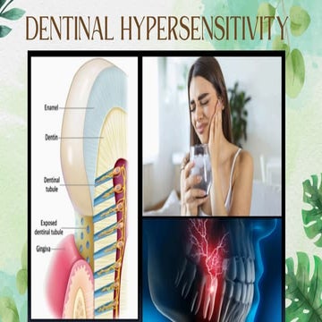 hypersensitivity of teeth and its management | PPTX