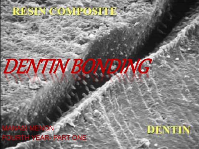 DENTIN BONDING AGENTS | PPT