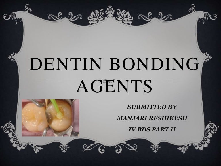 Dentin bonding agents