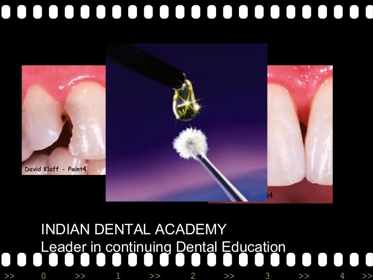 Dentin bonding agents final/cosmetic dentistry courses