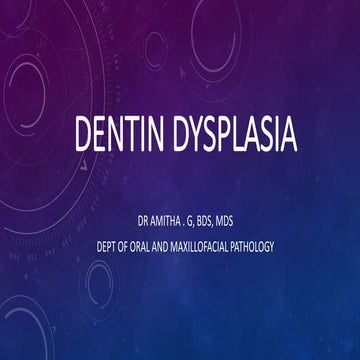 Dentin Dysplasia
