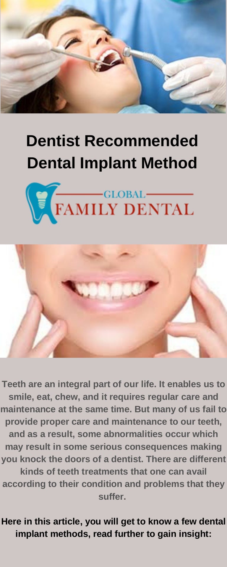 What are Dentist dental implant method Dental Implants