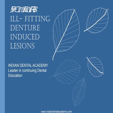 Denture induced lesions /orthodontic courses by Indian dental academy 