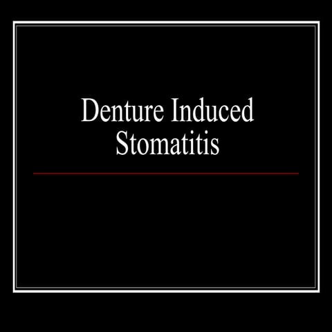Denture Stomatitis