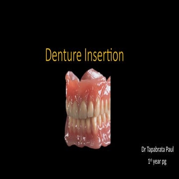 denture insertion prosthodontist in dentistry