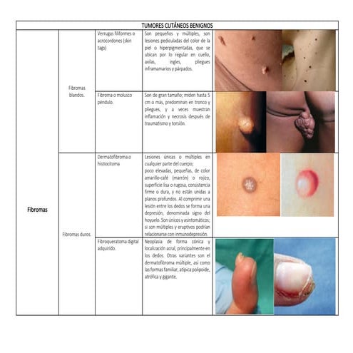 Derma - Tumores Cutáneos.pdf
