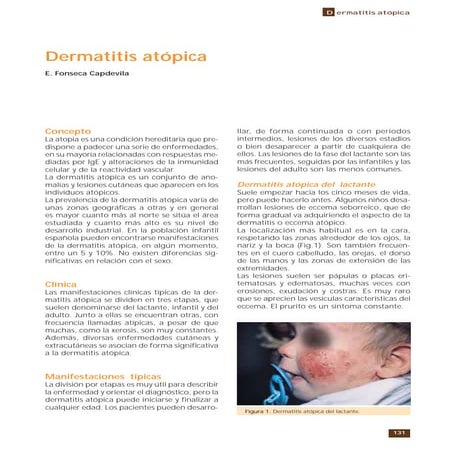 Dermatitis atopica pediatria | PPTX
