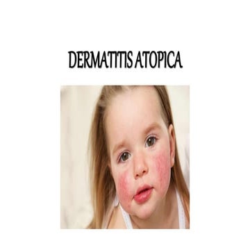 dermatitis atopica, definición, diagnósticos y tratamiento.pptx