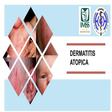DERMATITIS ATOPICA EN NIÑOS, MANEJO PEDIATRICO | PPTX