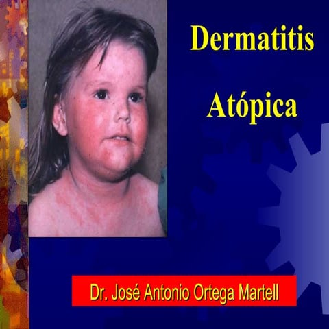 Dermatitis AtóPica