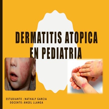 Dermatitis Atópica en Pediatría: Diagnóstico y Tratamiento Integral | PPTX