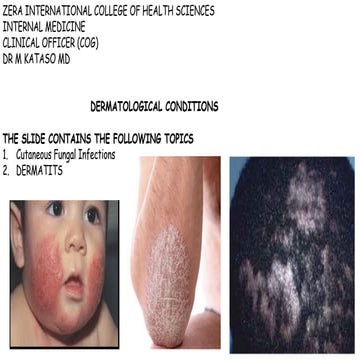 Tinea dermatophytes | PPT