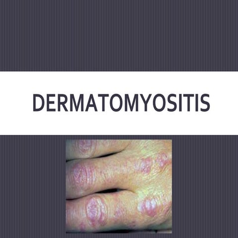 Dermatomyosesindermatolgyexlporedthoroughly