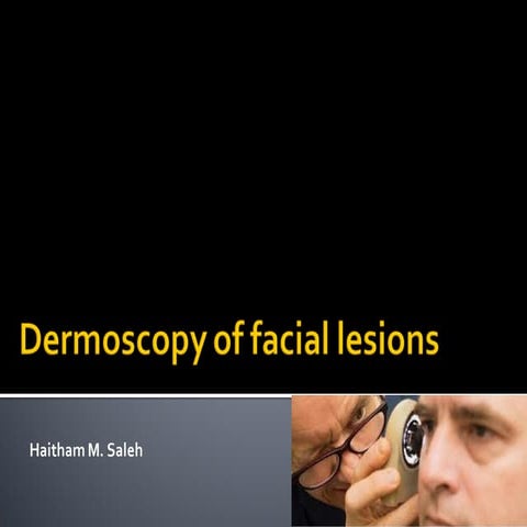 Dermoscopy in Dermatology: Principles, Patterns, and Clinical ...