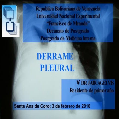 Derrame pleural