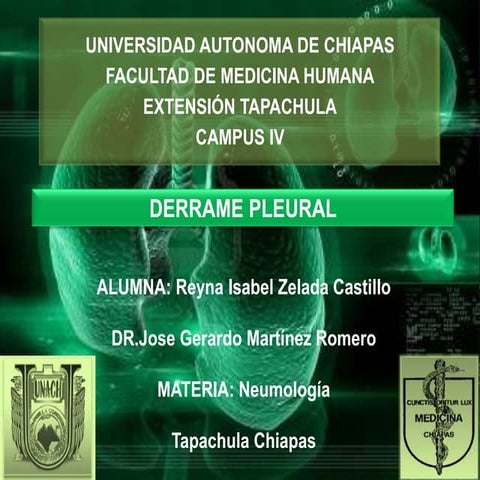 Derrame pleural